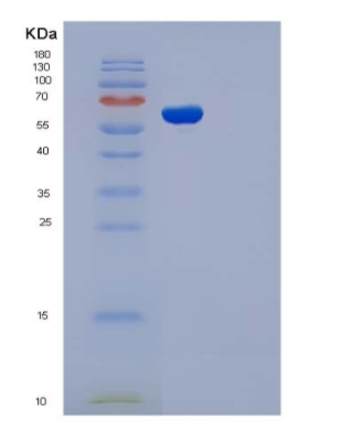 Recombinant Human ADSL / Adenylosuccinate Lyase Protein (His tag)