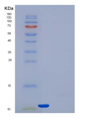 Recombinant Human Thioredoxin / TXN / SASP Protein