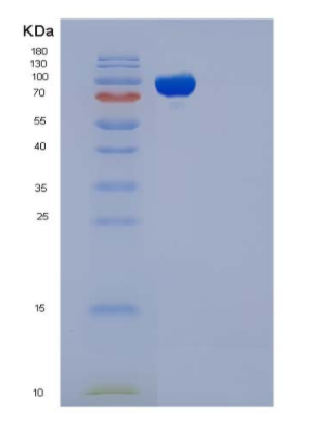 Recombinant Human EED / Embryonic Ectoderm Development Protein (His & GST tag)
