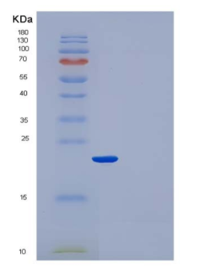 Recombinant Human CRP / C-Reactive Protein