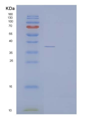 Recombinant Human ACYP1 Protein (GST Tag)