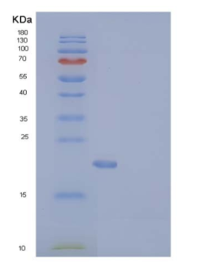Recombinant Human CD137 / 4-1BB / TNFRSF9 Protein (His tag)