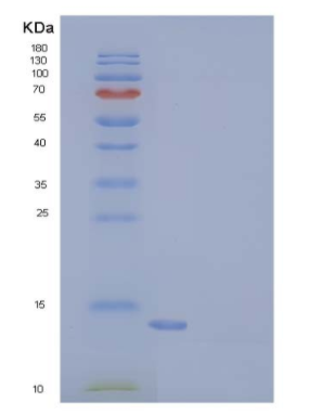 Recombinant Human LAIR2 / CD306 Protein, Low Endotoxin