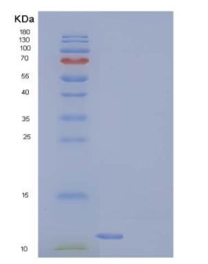 Recombinant Human COX5B Protein (His tag)