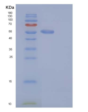 Recombinant Mouse S100A15 / S100A7A Protein (His & MBP tag)