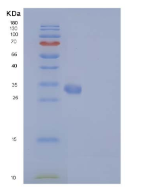Recombinant Mouse IL17RA / IL17R / CD217 Protein (His tag)