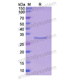 Recombinant Human LPL, N-His