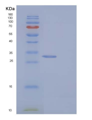 Recombinant Human BPHL Protein (His tag)