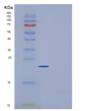 Recombinant Mouse CRP / C-Reactive Protein (His tag)