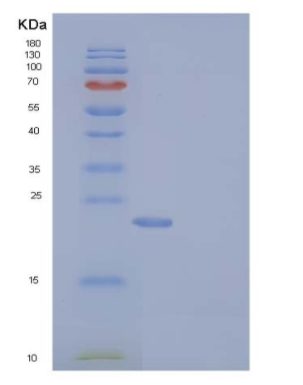 Recombinant Human RAB27B .