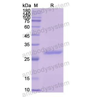 Recombinant Human TH, N-His
