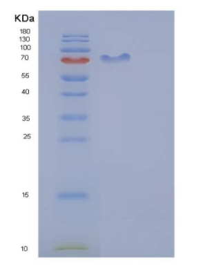 Recombinant Mouse CDC37 / CDC37A Protein (His & GST tag)