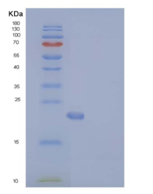 Recombinant Human N6AMT1 / HEMK2 Protein (His tag)