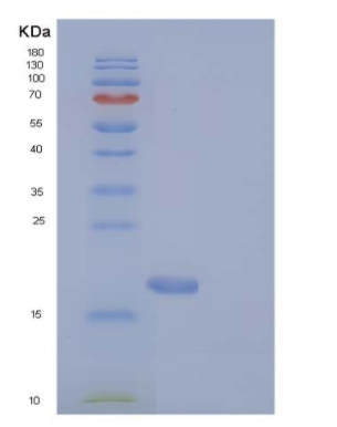 Recombinant Human MAGOH Protein (His tag)