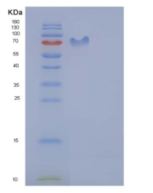 Recombinant Rat PDGFRB / PDGFR-1 Protein (Fc tag)