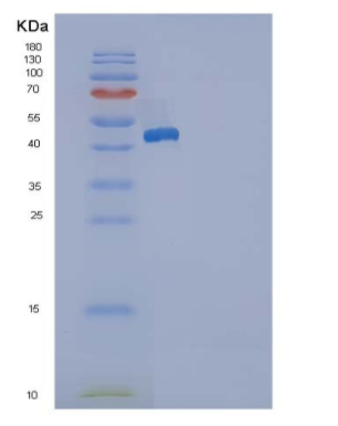 Recombinant Rat DDR2 Kinase / CD167b Protein (His tag)