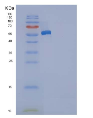 Recombinant Human ANP32A / PHAP1 Protein (His & GST tag)