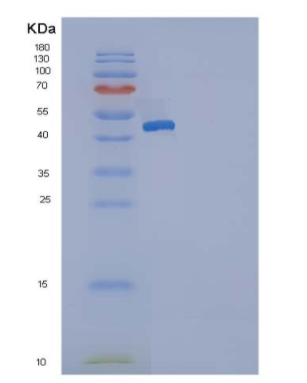 Recombinant Human SerpinG1 / C1 inhibitor / C1IN Protein (His tag)