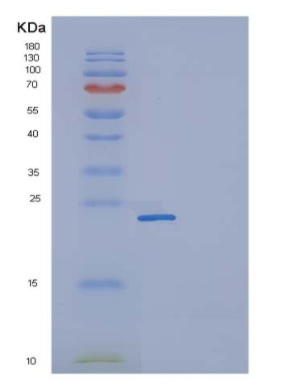 Recombinant Human CD32a / FCGR2A Protein (167 His, His & AVI tag), Biotinylated