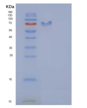 Recombinant Human ICAM-1 / CD54 Protein (His & Fc tag)
