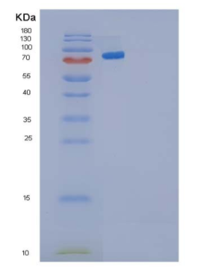 Recombinant Human Cadherin-3/CDH3 Protein(C-6His)