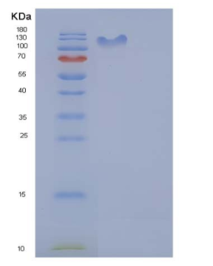 Recombinant Human UBE1 / UBA1 Protein (His & GST tag)