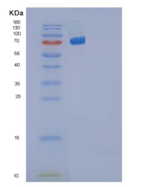 Recombinant Human IL-35 (IL12A &EBI3 Heterodimer) Protein (Fc Tag)
