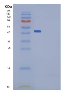 Recombinant Mouse Pleiotrophin / PTN / HB-GAM Protein (Fc tag)