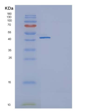Recombinant Human TNFRSF19 / TROY Protein (Fc tag)