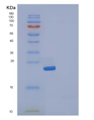 Recombinant Human IL19 / Interleukin-19 Protein (His tag)