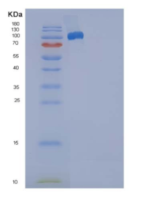 Recombinant Human SELP / selectin P / P-selectin Protein (Fc tag)