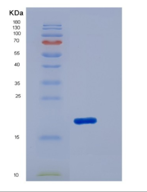 Recombinant Human IL18 / Interleukin 18 / IGIF Protein (GST tag)
