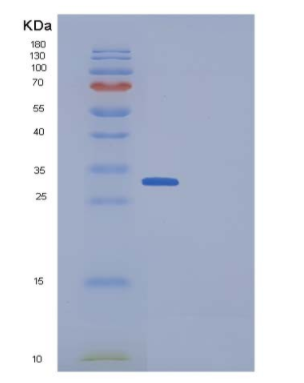 Recombinant Human DKK1 / Dkk-1 Protein (His tag)