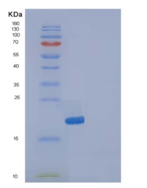 Recombinant Human IL1F5 / IL36RN Protein