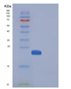 Recombinant Human MANF / ARMET Protein (His tag)