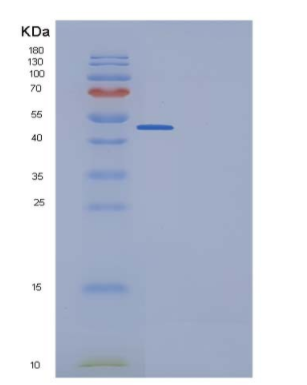 Recombinant Human Ephrin-B1 / EFNB1 Protein (His & Fc tag)