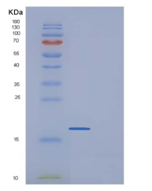 Recombinant Human IL17 / IL17A Protein (His tag)