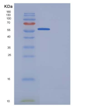 Recombinant Human Granulin / GRN / Progranulin Protein (His tag)