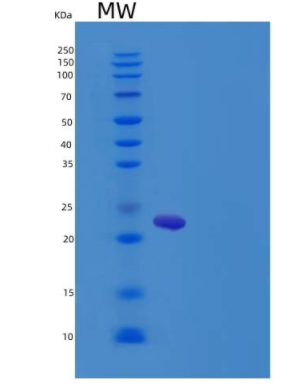 Recombinant Rat IGFBP6 / IBP6 Protein (His Tag)