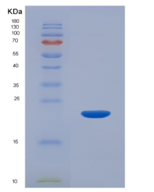 Recombinant Interleukin 1 Beta (IL1b).