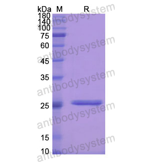 Recombinant Human PRSS1, N-His
