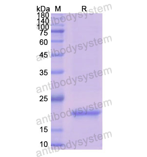 Recombinant Human CSN3, N-His