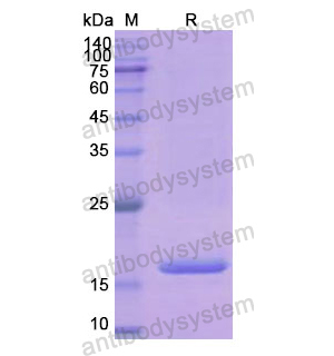 Recombinant Human PFN1, N-His