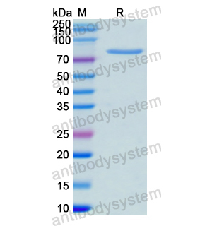 Recombinant Human HSP90AA1, N-His