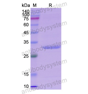 Recombinant Human UMOD, N-His