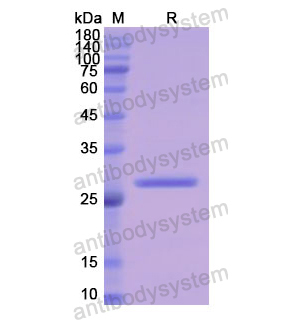 Recombinant Human LYN, N-His