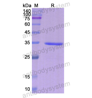Recombinant Human ERCC1, N-His