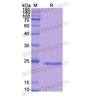 Recombinant Human THBS1, N-His