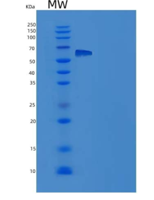 Recombinant Rat EphA4 Protein (His tag)