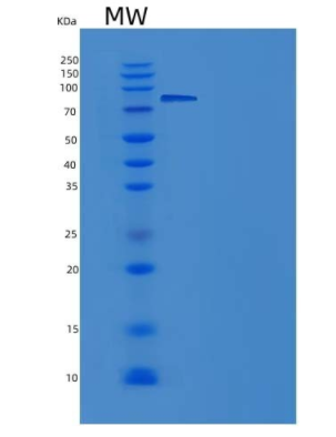 Recombinant Rat EphA4 Protein (Fc tag)